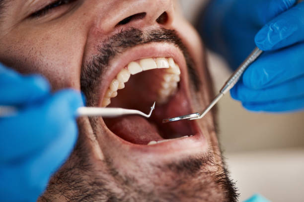 Best Urgent Tooth Repair  in Fremont, OH